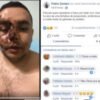 Vereador de oposição leva uma surra e acusa prefeito, em Tavares – Paraíba