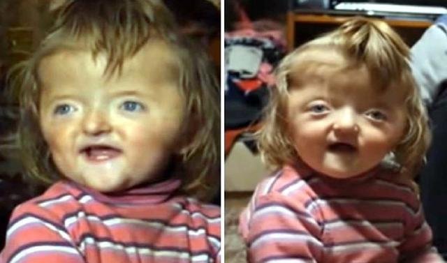 Menina de 2 anos é proibida de ir à creche para não assustar outras crianças, Rússia