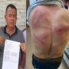 Vereador de Bom lugar é emboscado e espancado em estrada vicinal de Bacabal