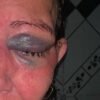 Mulher estuprada e agredida com socos em Caxias MA