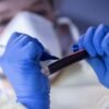 Casos semanais de covid-19 voltam a subir no Brasil