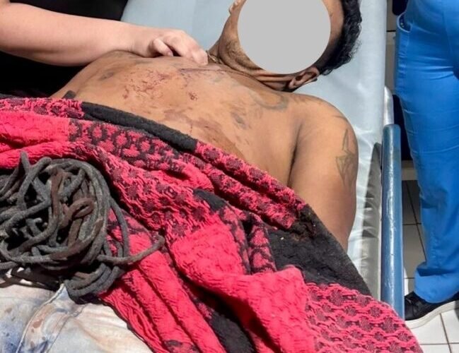 Homem conhecido como “Casca de Bala” corta pneu de viatura da Polícia Civil e morre em troca de tiro com policiais em Tuntum