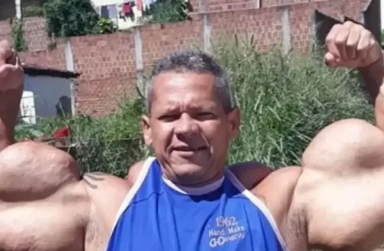 Morre Arlindo de Souza, conhecido como “Popeye Brasileiro”