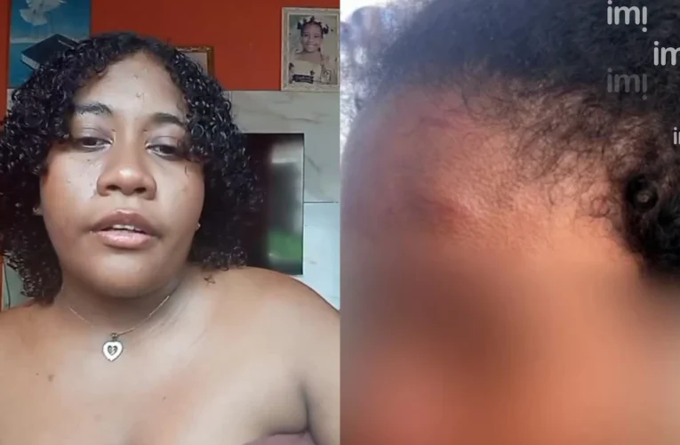 Doméstica diz ter perdido 50% da audição após agressões da patroa no MA